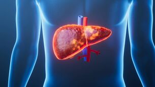 <p>There are now 1.3 billion people worldwide living with MASLD, the latest estimates suggest, a 143% increase in just three decades. About one in six people — 16% — are affected.</p> <p>There are now 1.3 billion people worldwide living with MASLD, the latest estimates suggest, a 143% increase in just three decades. About one in six people — 16% — are affected.</p>