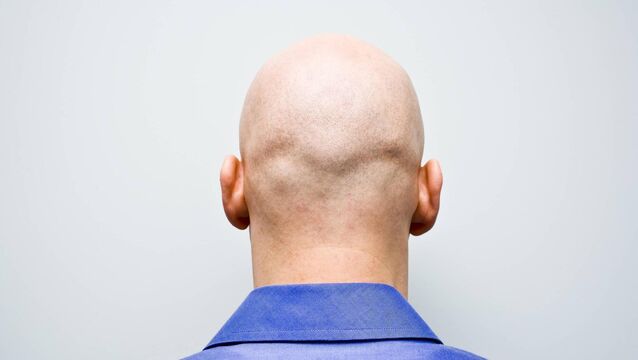 <p>45% of men will begin to experience hair loss by the time they are 50, with one in three likely to start losing hair by the age of 35.</p>