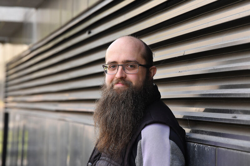Tiernan Ó hAlmhain, who began noticing hair loss at age 18. Photograph Moya Nolan Tiernan Ó hAlmhain, who began noticing hair loss at age 18. Photograph Moya Nolan