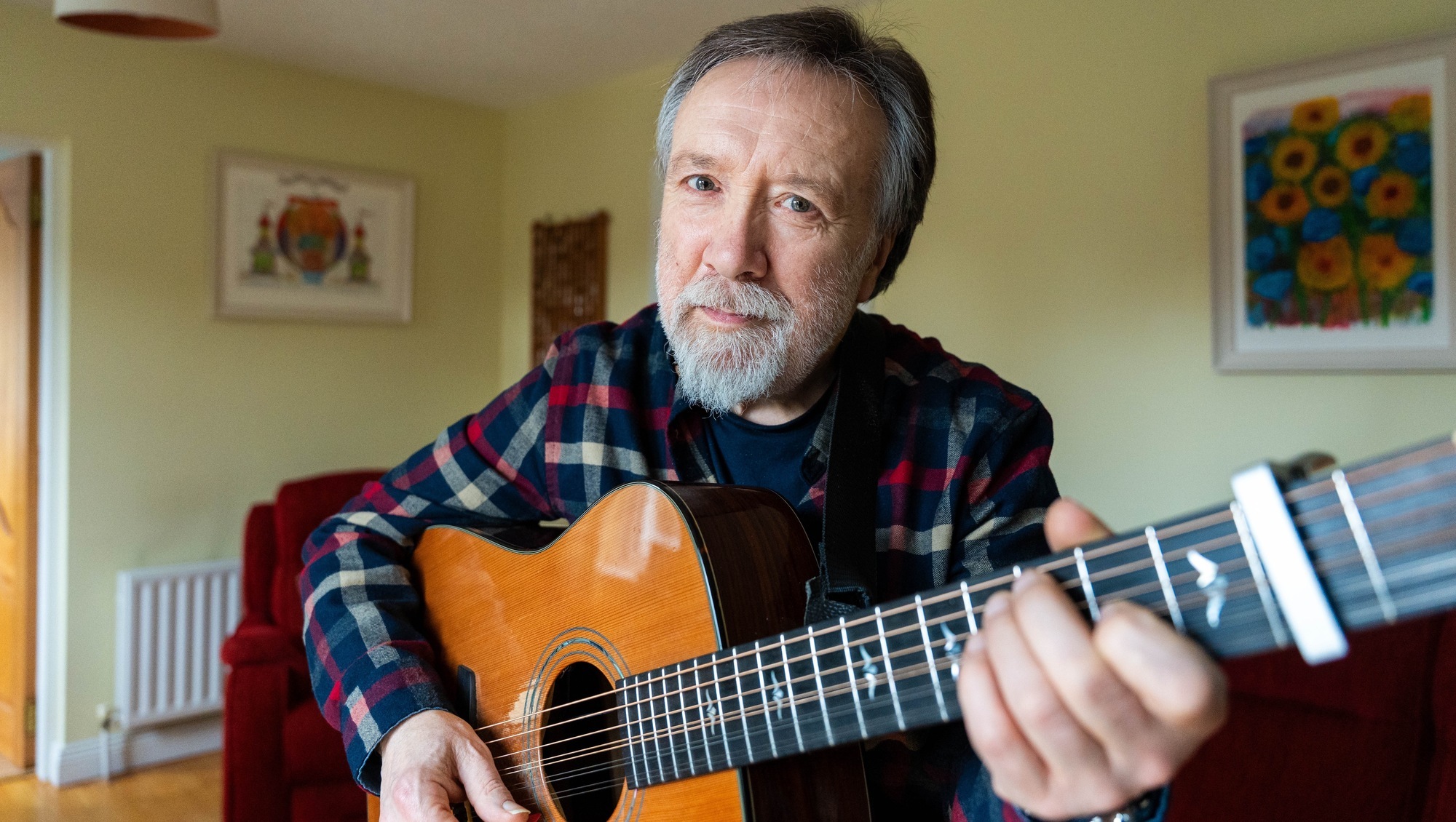 My life with John Neville: 'Alopecia is the reason I became a musician'