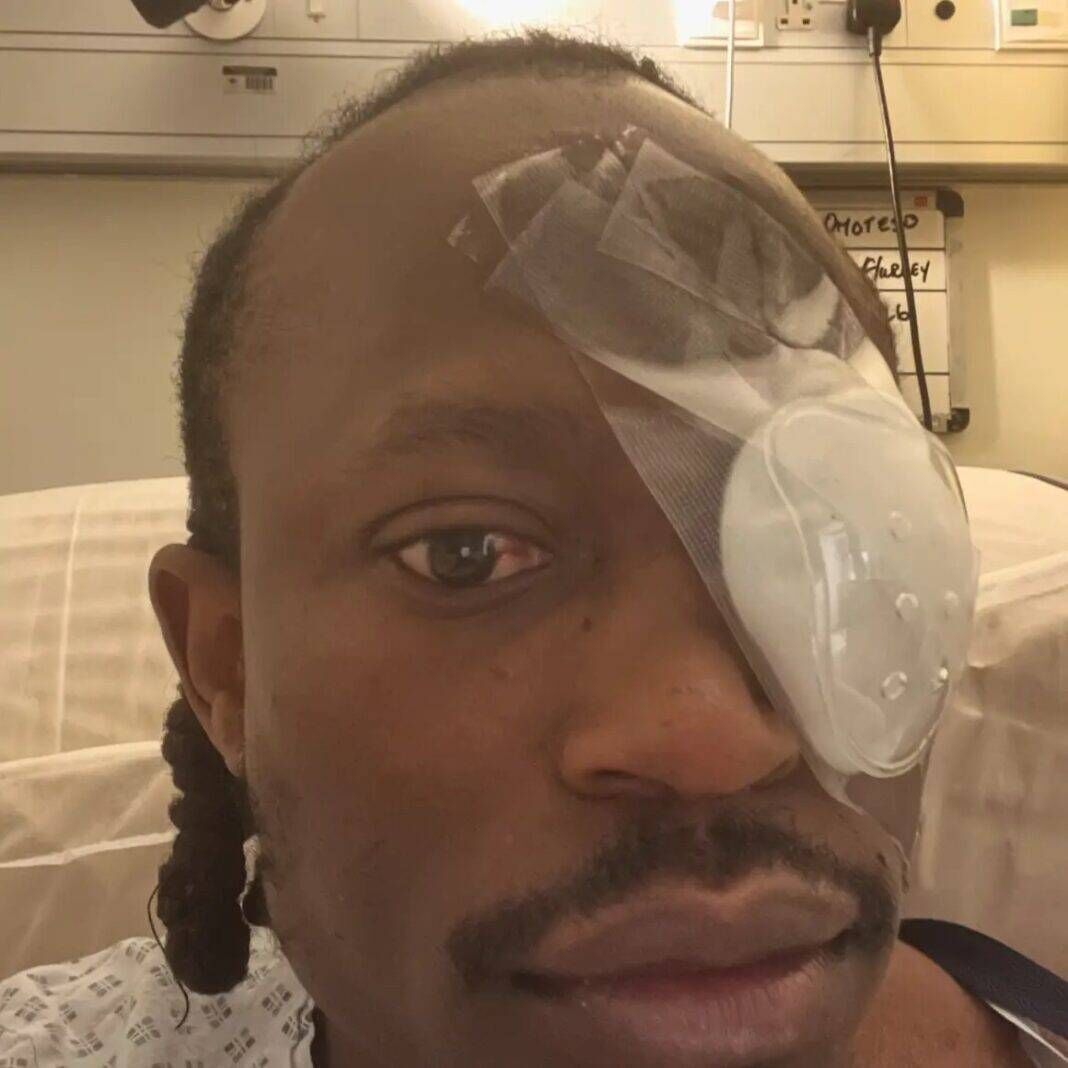 Tobi Omoteso was assaulted in Limerick city on Saturday, March 28. Tobi Omoteso was assaulted in Limerick city on Saturday, March 28.
