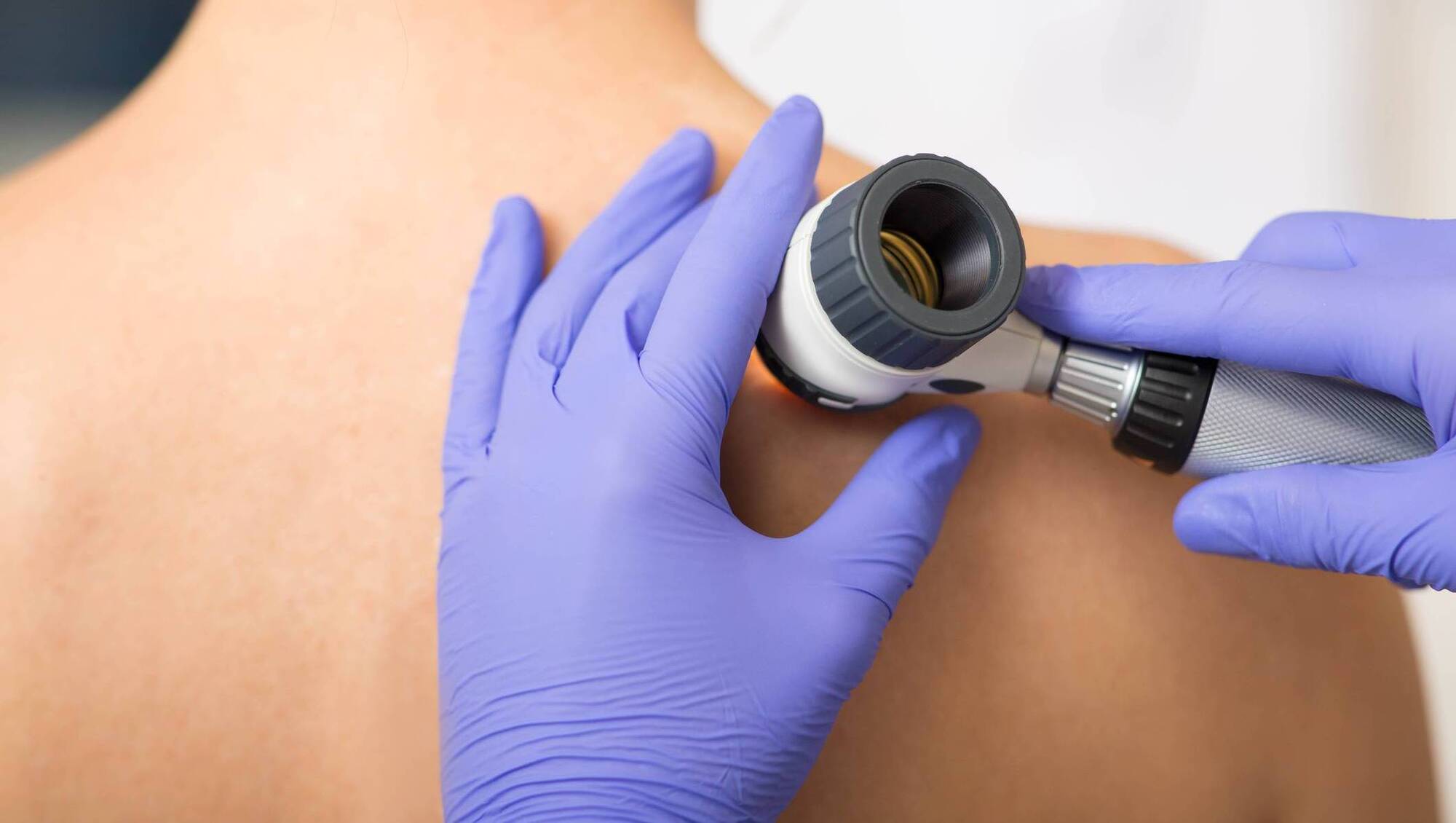 Almost a tenth of people on hospital lists awaiting dermatology care