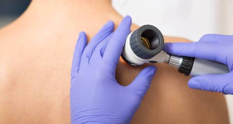 dermatologist Inspecting patient skin moles at clinic
