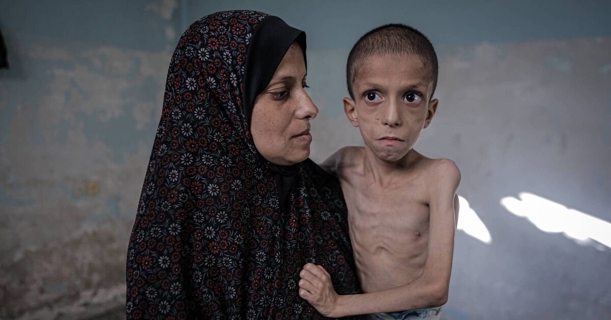 Global food systems are under fire due to a lack of political will