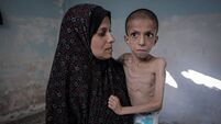 10-year-old Nafez fight malnutrition and brain atrophy as hunger crisis worsens in Gaza