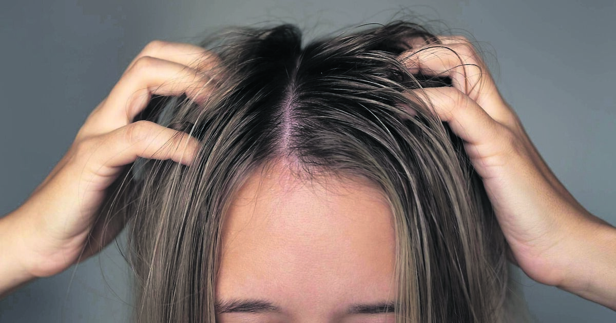 Getting to the root of thinning hair: “If our hair's off, we don't feel right.”