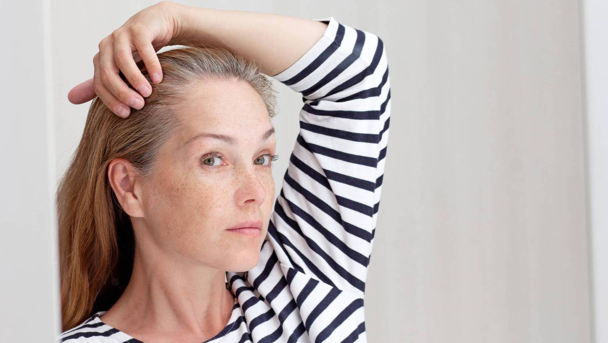 Natural Health: What can I do about my thinning eyebrows?