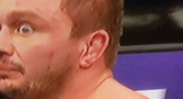 MMA fighter suffers hideous eye injury at UFC Fight Night 81