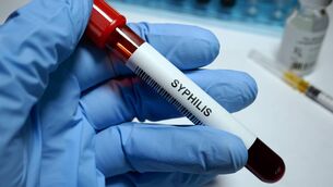 <p>Chlamydia was the most frequently reported STI, with 213,443 cases in Europe. Picture: iStock</p> <p>Chlamydia was the most frequently reported STI, with 213,443 cases in Europe. Picture: iStock</p>