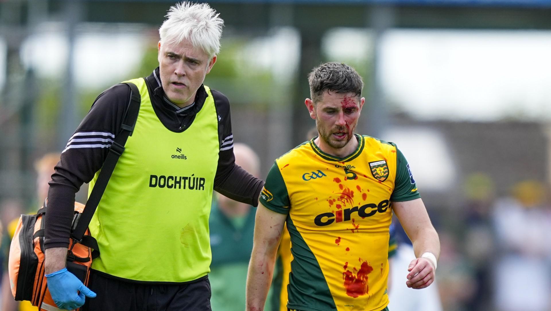 Micheál Burns sees red for strike on McHugh after mass brawl in Kerry-Donegal clash