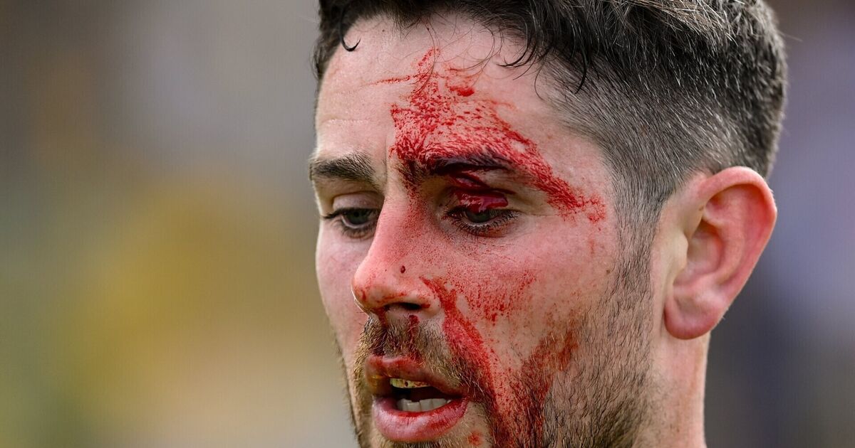 'You can grapple but you can't hit' - RTÉ pundits condemn Kerry's Burns over McHugh punch