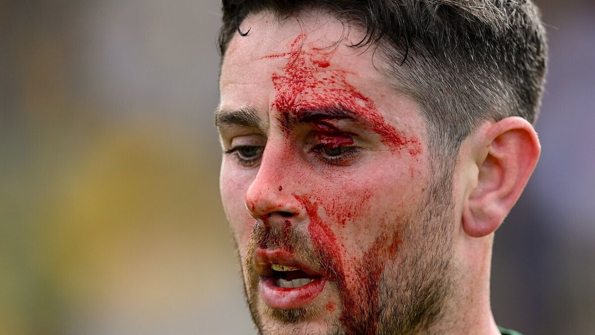 'You can grapple but you can't hit': Pundits condemn Kerry's Burns over McHugh punch