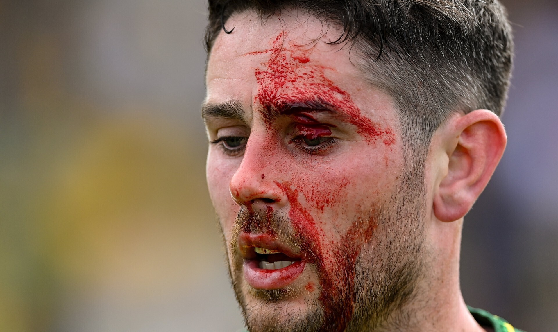 'You can grapple but you can't hit': Pundits condemn Kerry's Burns over McHugh punch