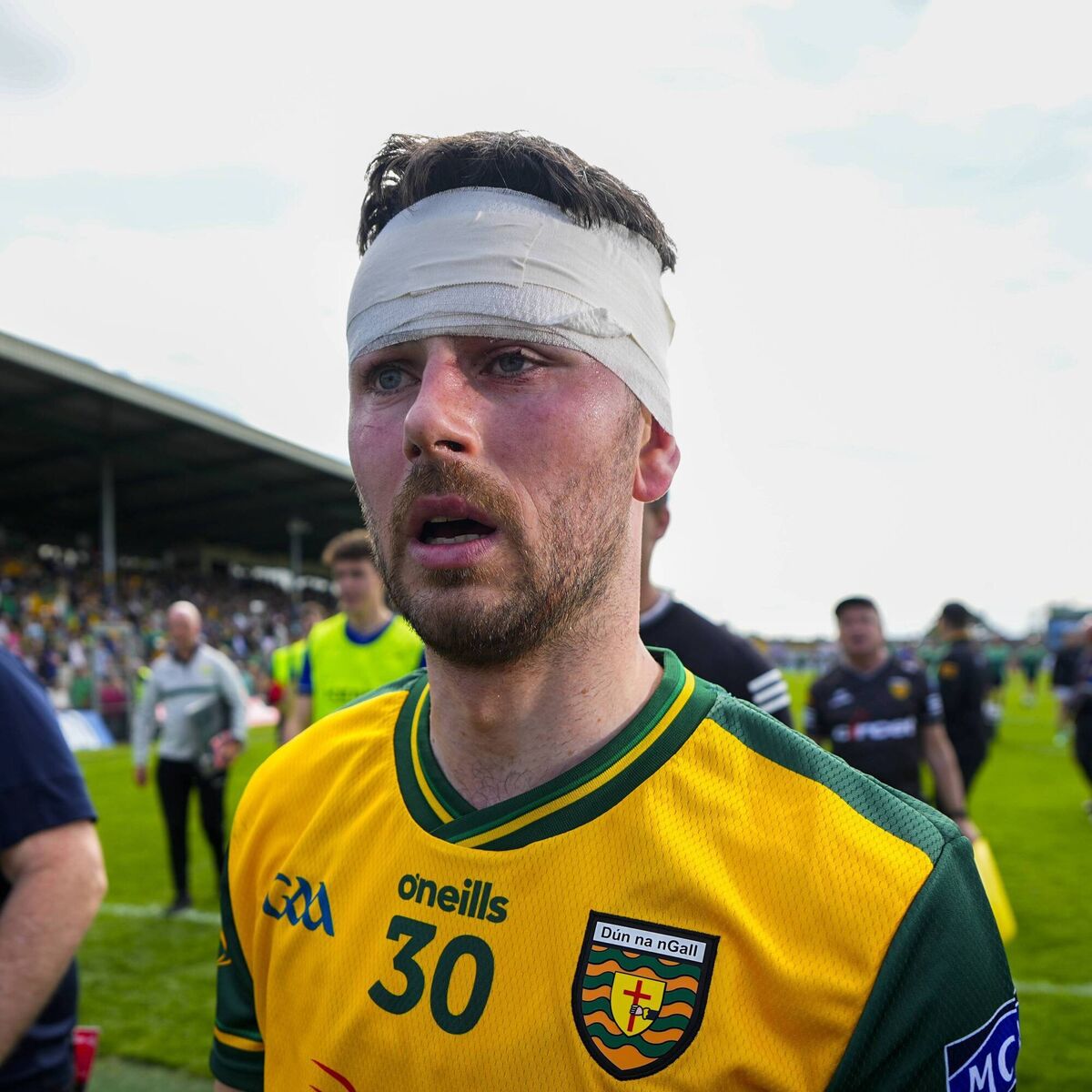 BATTLE SCARS: Donegal's Ryan McHugh in the wake of their victory over All-Ireland champions Kerry at Fitzgerald Stadium. Pic: James Lawlor, Inpho BATTLE SCARS: Donegal's Ryan McHugh in the wake of their victory over All-Ireland champions Kerry at Fitzgerald Stadium. Pic: James Lawlor, Inpho