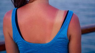 <p>Sunburn can be an incredibly sore, itchy and irritating experience and one that we should all try to avoid. Picture: iStock </p> <p>Sunburn can be an incredibly sore, itchy and irritating experience and one that we should all try to avoid. Picture: iStock </p>