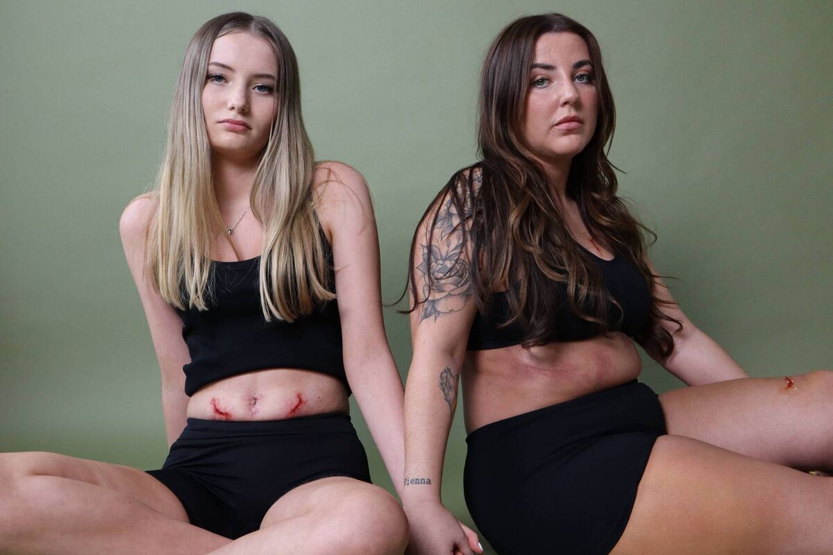 Endometriosis patients Ella O'Riordan and Lisa Walsh posed for one of the billboards. Picture: Her Voice Project Endometriosis patients Ella O'Riordan and Lisa Walsh posed for one of the billboards. Picture: Her Voice Project