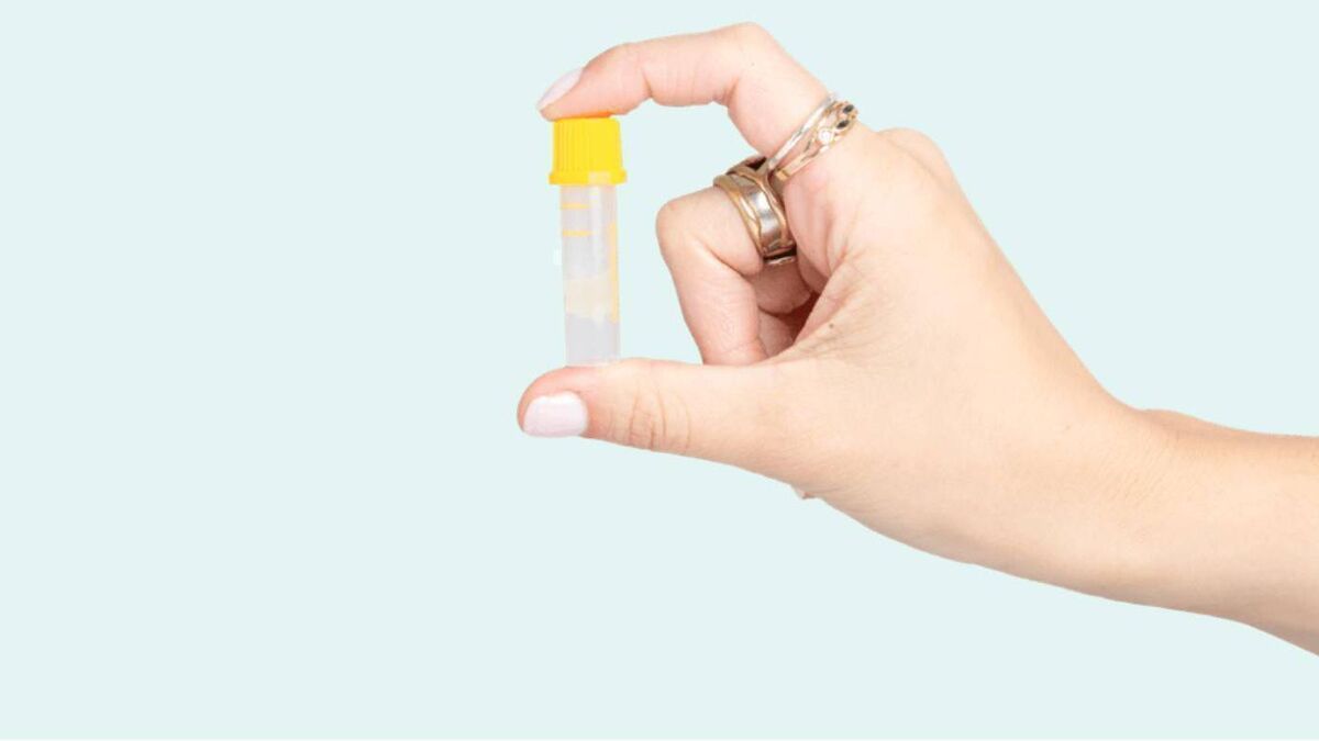 Ireland records more than 18,900 STI cases as WHO targets remain out of reach