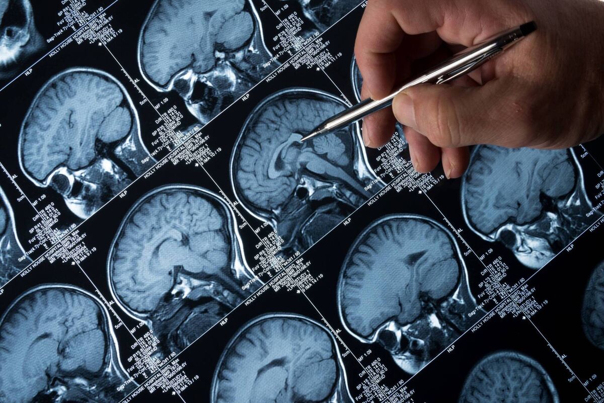 Dementia is often portrayed as a 'living death' which is damaging as it presumes that the person with the disease has already disappeared. 