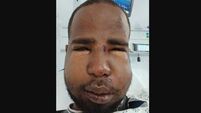 Homeless man ‘lucky’ he didn’t die after gang attack