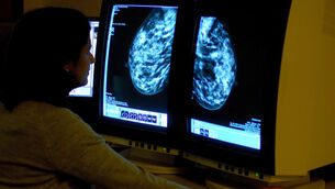 <p>The HSE report says Ireland continues to face challenges in areas including higher antibiotic use, avoidable hospital admissions, limited long-term care staffing, and lower availability of diagnostic imaging equipment.</p> <p>The HSE report says Ireland continues to face challenges in areas including higher antibiotic use, avoidable hospital admissions, limited long-term care staffing, and lower availability of diagnostic imaging equipment.</p>