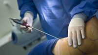 Liposuction