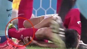 One player suffered a horrible injury against Barcelona in the Club World Cup today