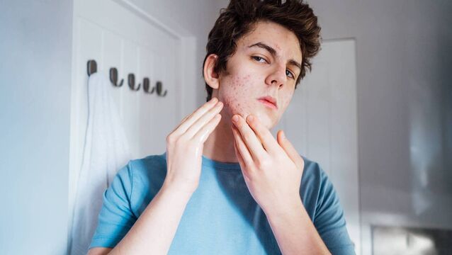<p>Zinc is what the body needs to improve skin integrity, especially in healing and scar repair. Zinc even plays a role in the regulation of oil production in the skin.</p>