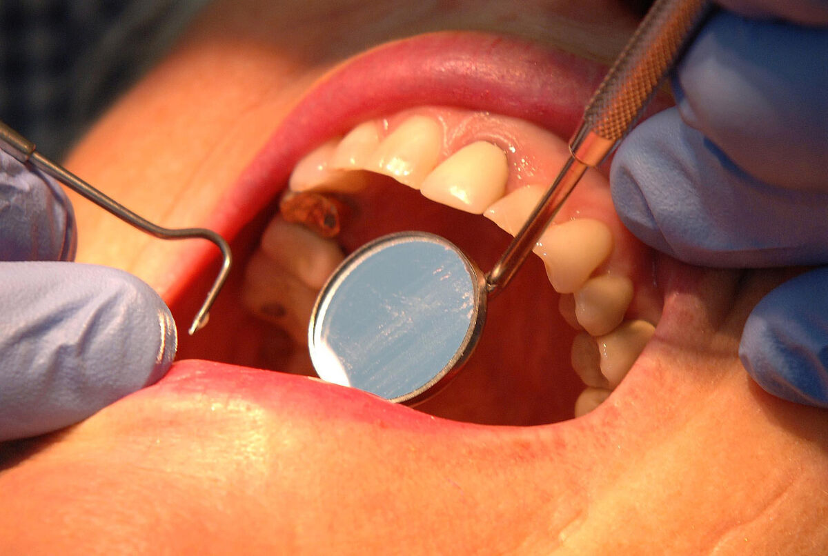 Figures provided to Sinn Féin TD David Cullinane showed 804 patients were waiting over 48 months to access extreme, complex orthodontic treatments (grade 5). Figures provided to Sinn Féin TD David Cullinane showed 804 patients were waiting over 48 months to access extreme, complex orthodontic treatments (grade 5).