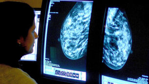 <p>Studying centrosomes, tiny structures that help divide DNA evenly when a cell makes a copy of itself, in tumour tissues has proved 'extremely challenging' because of their tiny size and constant changing. File photo: Rui Vieira/PA</p> <p>Studying centrosomes, tiny structures that help divide DNA evenly when a cell makes a copy of itself, in tumour tissues has proved 'extremely challenging' because of their tiny size and constant changing. File photo: Rui Vieira/PA</p>