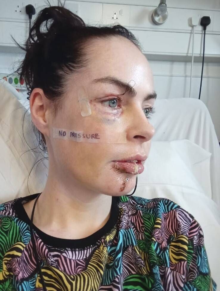 Róisín Stakelum in hospital recovering from her injuries in 2023.