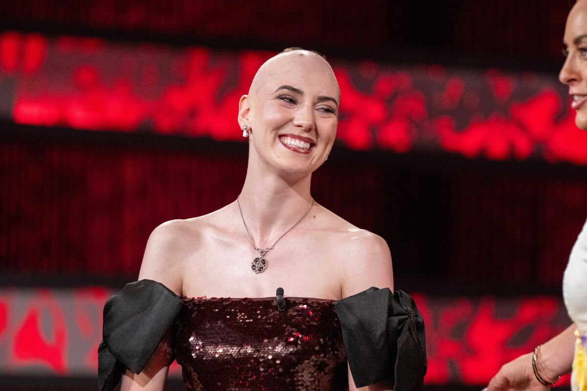 Caoilfhinn Ní Choiligh is studying to be a wigmaker, having dealt with alopecia since she was 15. Picture: Domnick Walsh Caoilfhinn Ní Choiligh is studying to be a wigmaker, having dealt with alopecia since she was 15. Picture: Domnick Walsh