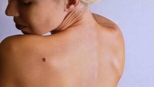 <p>Beyond melanoma, personalised cancer vaccines are in late-stage development for a host of tumour types. Stock picture</p> <p>Beyond melanoma, personalised cancer vaccines are in late-stage development for a host of tumour types. Stock picture</p>