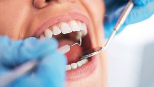 <p>Concerns have been raised about people who are unable to see a dentist and may end up have teeth extracted which could have been saved. Stock picture</p>
