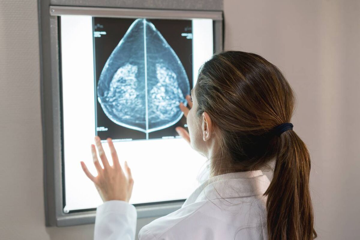BreastCheck services are offered to people aged 50-59. File picture