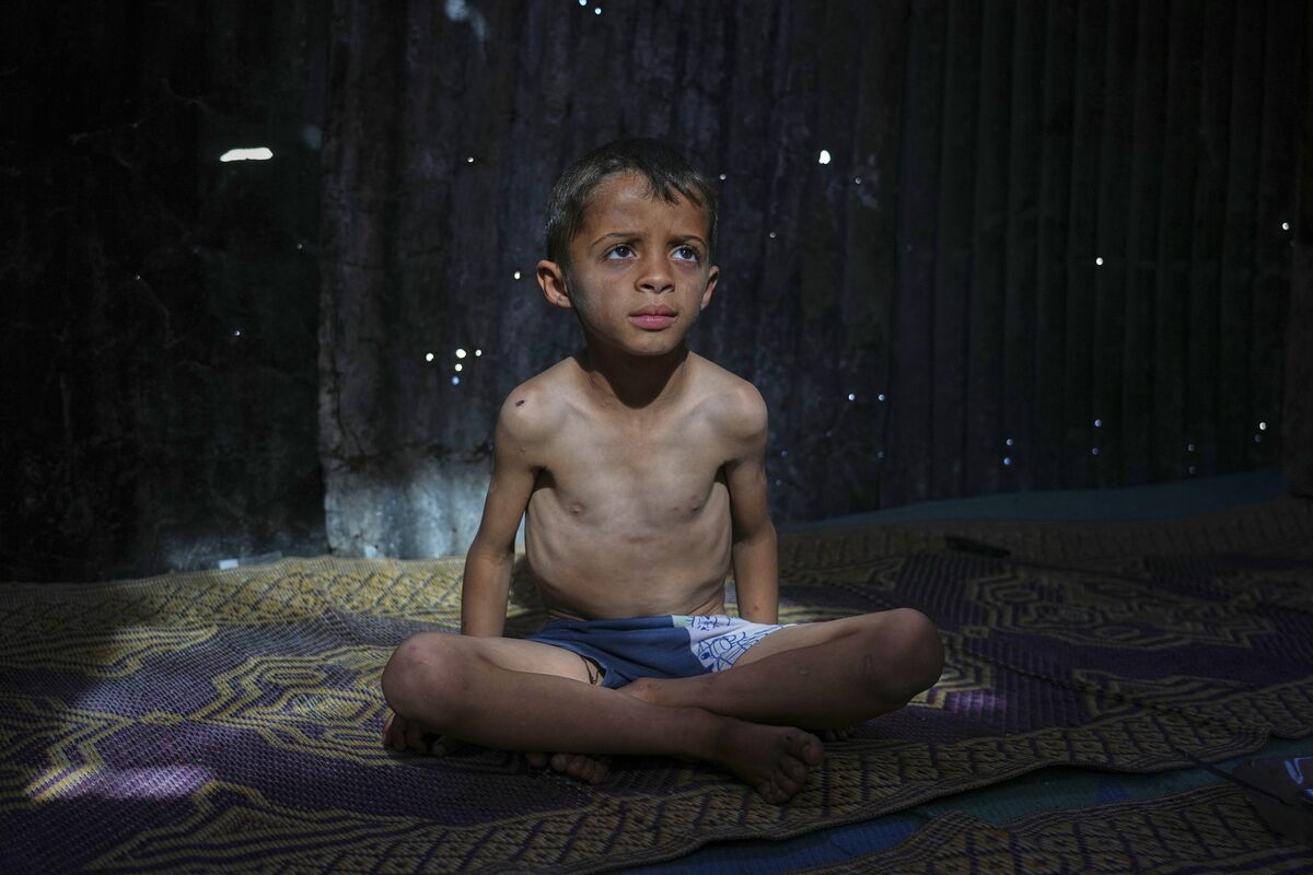 Ahmed El-Sheikh Eid, 7, who shows signs of malnutrition at his family’s tent at a camp for displaced Palestinians in Mawasi Khan Younis, Gaza Strip. Picture: Abdel Kareem Hana/AP
Ahmed El-Sheikh Eid, 7, who shows signs of malnutrition at his family’s tent at a camp for displaced Palestinians in Mawasi Khan Younis, Gaza Strip. Picture: Abdel Kareem Hana/AP