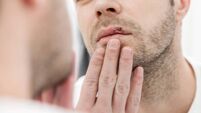 Young man suffering from herpes on his mouth