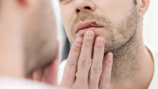 <p>Megan Sheppard: Applying raw garlic to the cold sore is not something that I would recommend Picture: iStock</p>