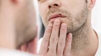 Young man suffering from herpes on his mouth