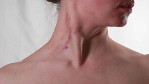 <p>We’re allowing choking to be sold as a safe sexual practice because, make no mistake, money is being made from this, when all the research strongly says it never is.</p>