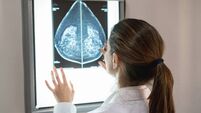 Unrecognizable female gynocologist looking at a mammogram at the hospital