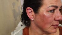 Woman found dead in Dublin posted photo of herself with facial injuries hours earlier
