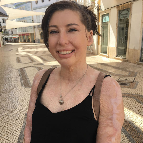 Catrin on a recent holiday in Portugal.