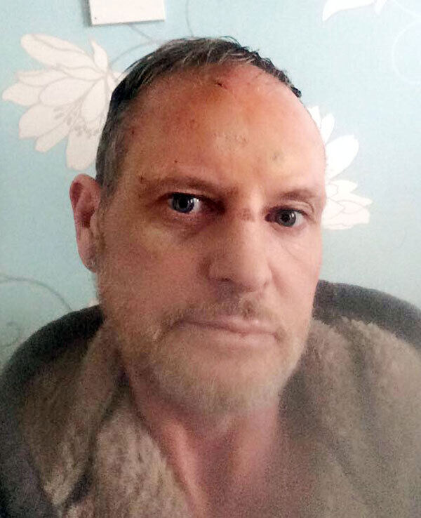 Handout photo courtesy of A1 Sporting Speakers of former footballer Paul Gascoigne, who has struggled with alcoholism for a number of years, recovering after another relapse. Handout photo courtesy of A1 Sporting Speakers of former footballer Paul Gascoigne, who has struggled with alcoholism for a number of years, recovering after another relapse.