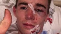 Irish jockey who was run over by an ambulance says there’s ‘no question of me quitting’