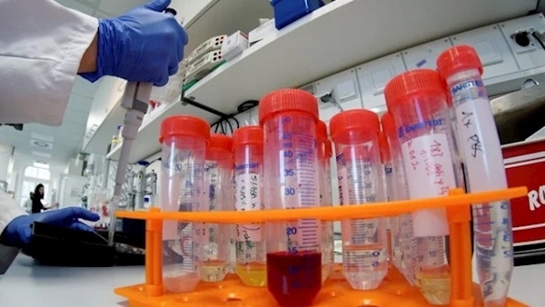 Our biosecurity put in jeopardy - Rabies-like virus found in pet
