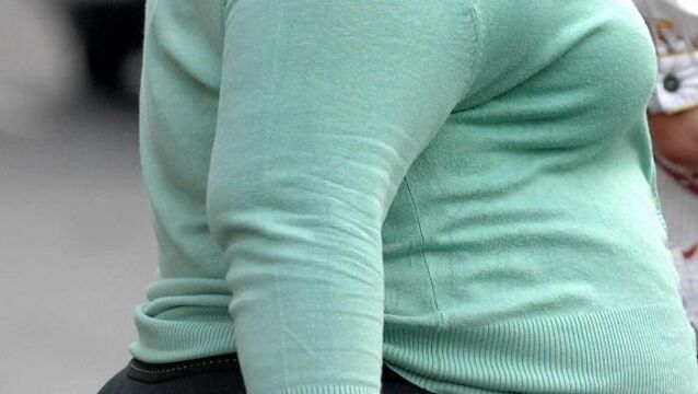 Dublin to host 2020 International Obesity Conference