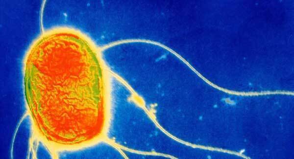 Over 50 people, including children, suffer food poisoning in outbreak linked to Dublin pub
