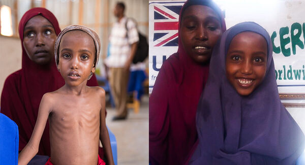 Yasmiin and her mother when she arrived at the clinic and three months later. Yasmiin and her mother when she arrived at the clinic and three months later.