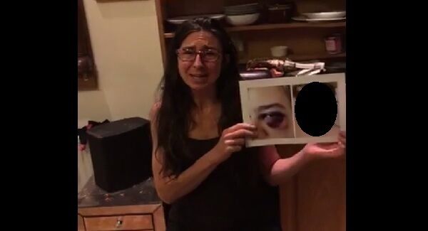 Adrienne Murphy holds up a picture of her son showing the injuries sustained during one of his violent outbursts.