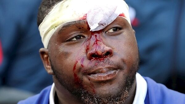 Demba Bamba dejected after the game. Credit ©INPHO/Dan Sheridan